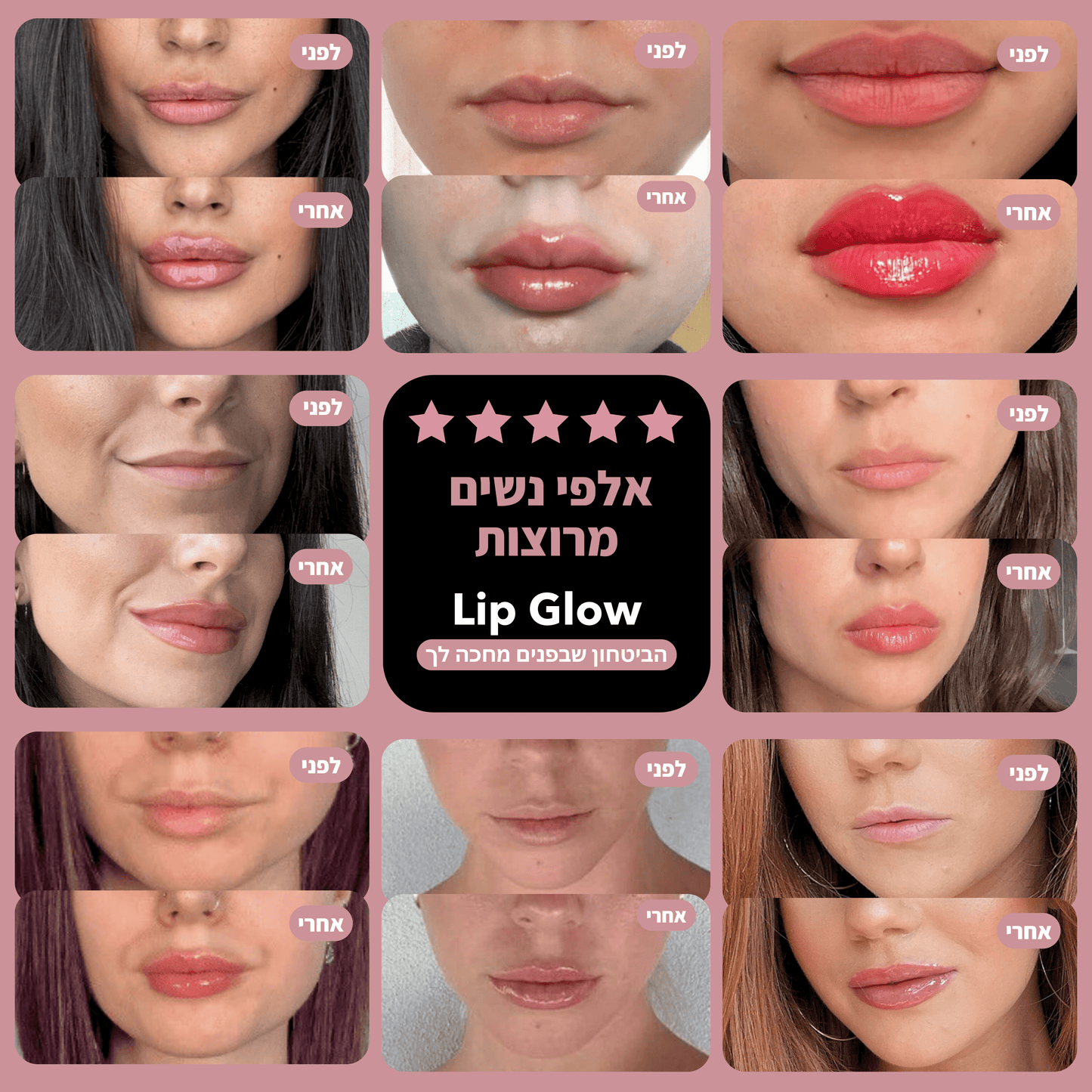 Lip Glow® - מנפח שפתיים ומעשיר בלחות